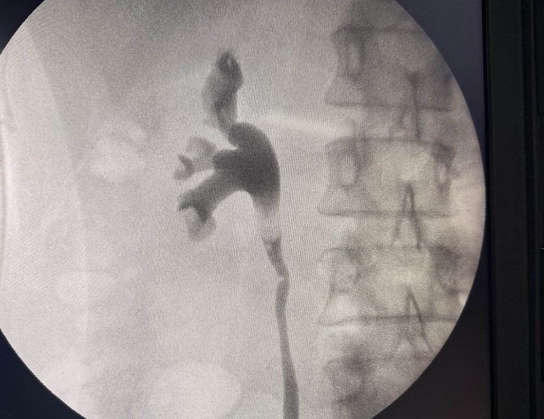 Imagen fluoroscópica del tracto urinario sin datos personales